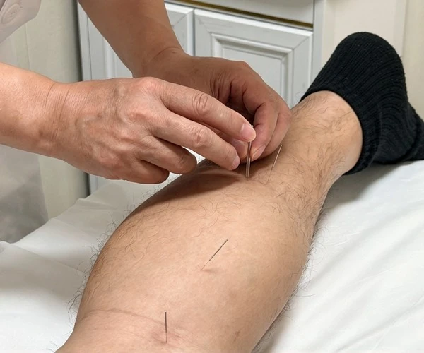 Acupuncture clinic room / 针灸诊室
